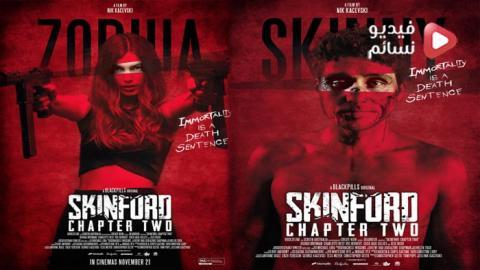 مسلسل Skinford الموسم 1 الحلقة 4 مترجم HD